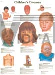 Children's Diseases - Anatomical Chart